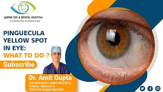 Pinguecula Yellow Spot in Eye: What to do ?