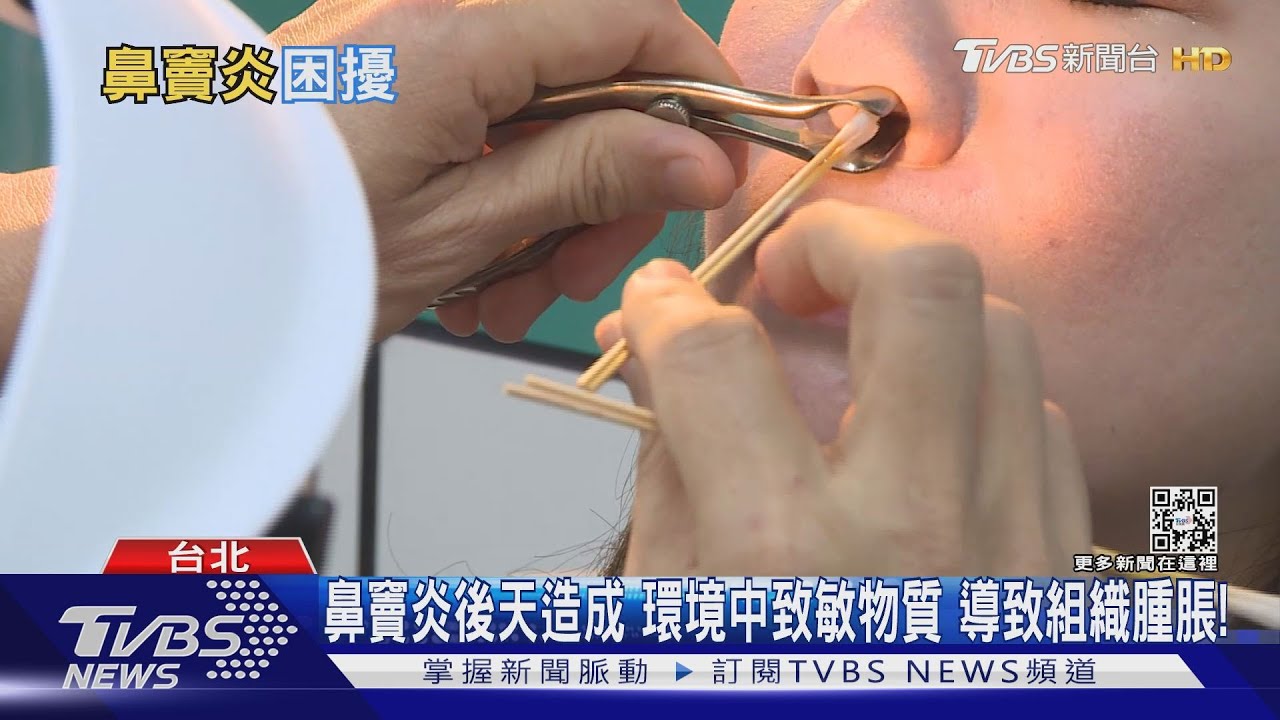 鼻涕變濃、咳嗽有痰...臺灣1/5人口被「這疾病」困擾... 醫:憂心!