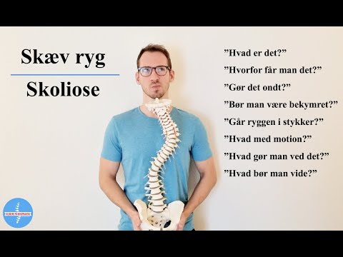 Hvad er en skæv ryg (skoliose)?
