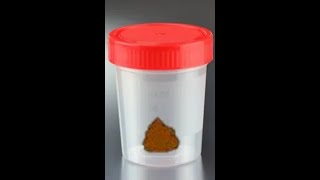 Video toma de muestra para un coprocultivo