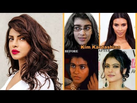 download lagu mp3 mp4 Celebrities With Laser Hair Removal, download lagu Celebrities With Laser Hair Removal gratis, unduh video klip Celebrities With Laser Hair Removal