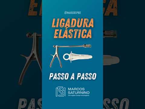 Marcos Saturnino-10