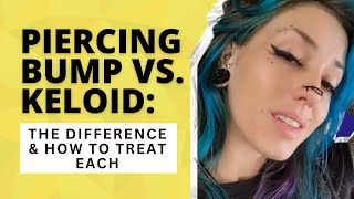 Dealing with a Piercing Bump or Keloid? Here
