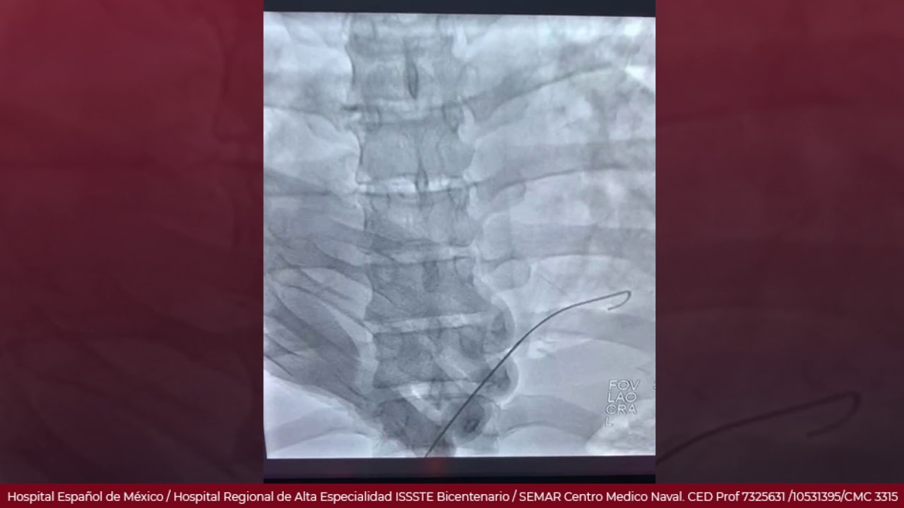 Marcelo Utrera Lagunas-98