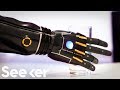 Bionic arm