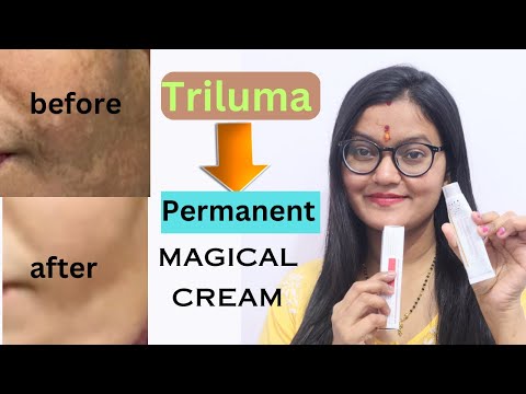 Triluma Cream, Pack Size: 15 g