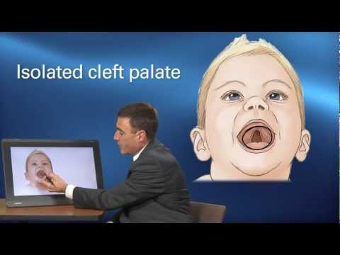 Cleft Treatment - Pediatric Playbook - Boston Children's Hospital