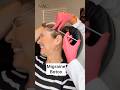 Migraine Botox #drbitafarrell #botox #naturalaestheticscenter #migraine