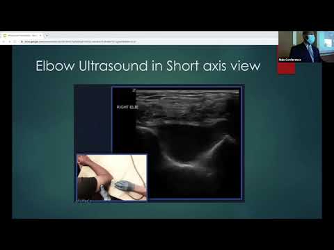 Dr Riggins   Ultrasound Lecture Series   Fractures; Femur, Elbow, and Intra Articular Blocks