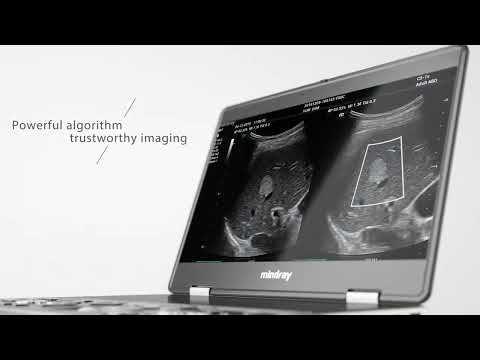 MX7 Point of Care Ultrasound Machine