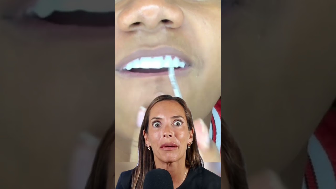 Watch DIENTES SUPER BLANCOS con una Técnica Casera Revolucionaria con ASOMBROSOS RESULTADOS 😂 Now DIENTES SUPER BLANCOS con una Técnica Casera Revolucionaria con ASOMBROSOS RESULTADOS 😂
