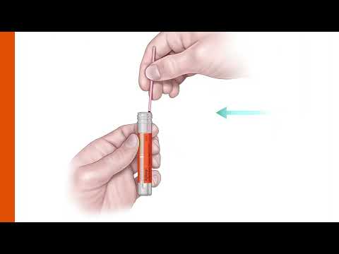 Nuswab Test For