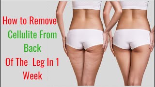 How to Remove Cellulite from the Back of Legs in a Week