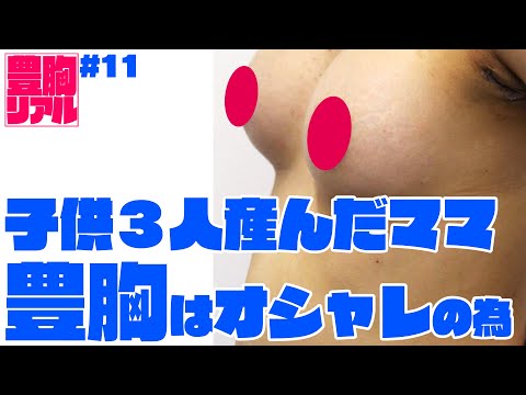 【子育てママ 豊胸】子供を３人産んだママが豊胸した理由はオシャレ | 美容整形は東京美容外科