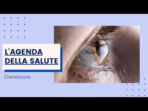 I problemi del cheratocono: l'ipotesi del trapianto di cornea