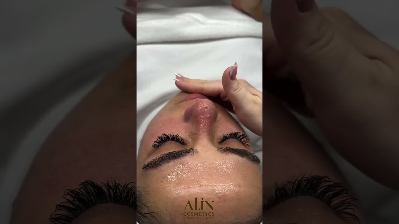 טיפולי עור בקריית ים