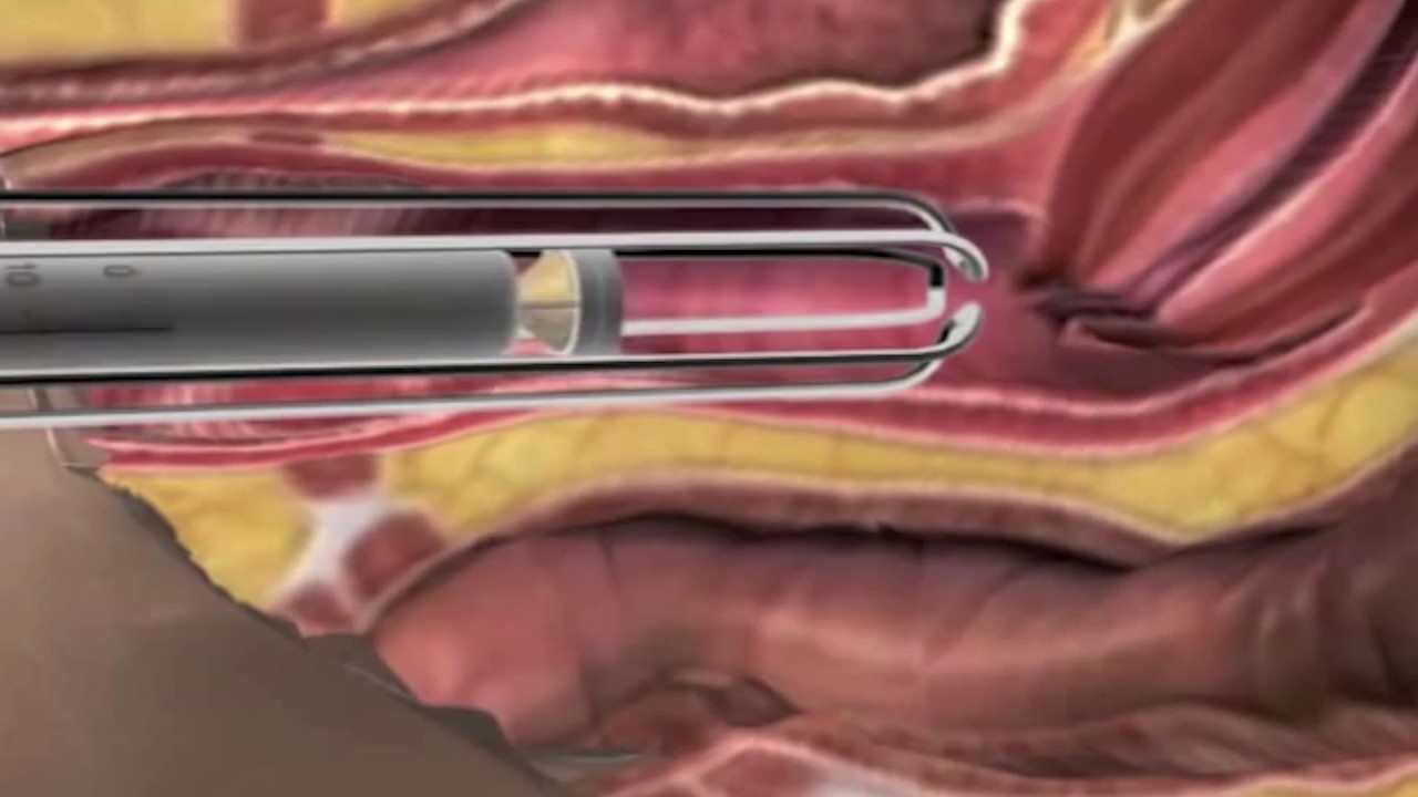 Denise De Souza Blaszkowski-5