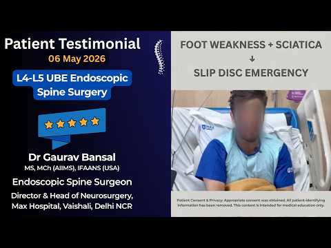 From Cauda Equina Syndrome to Recovery | Endoscopic Spine Surgery Patient Story