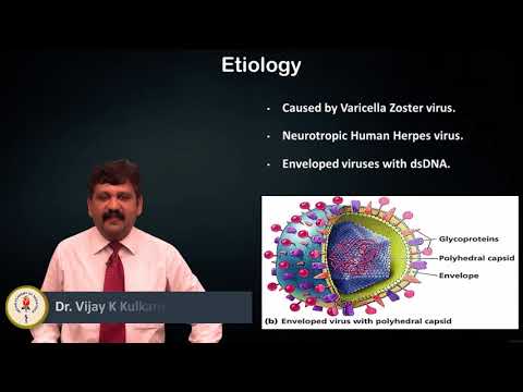 Varicella Zoster infection - Dr. Vijay Kulkarni
