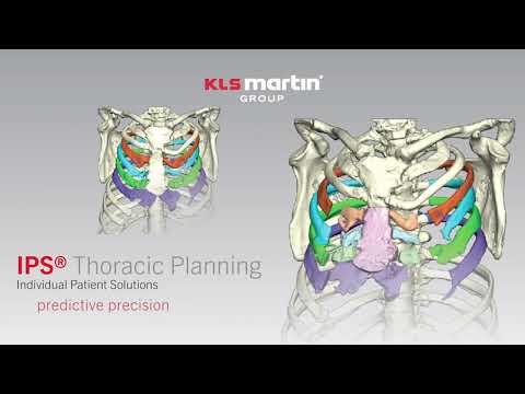 IPS® Thoracic Planning