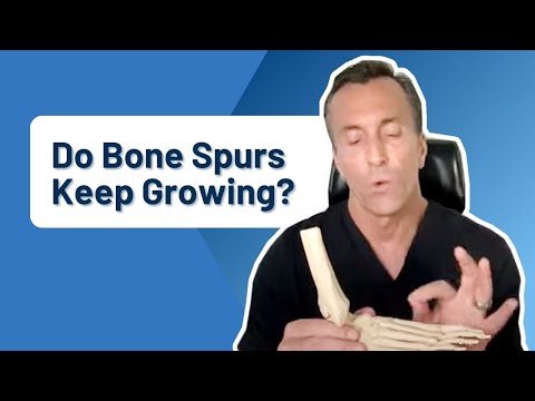 What Are Bone Spur Treatment Options