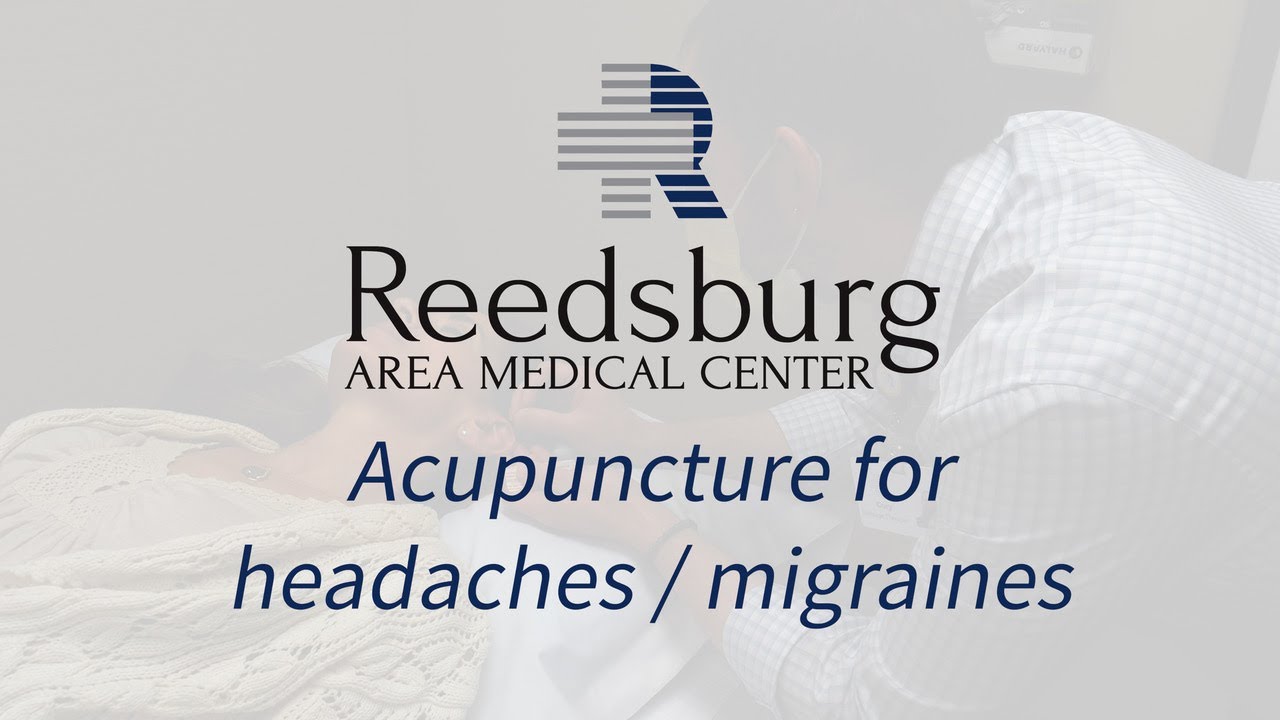 Acupuncture for headaches
