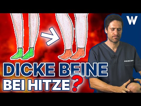 Angeschwollene Füße & Beine im Sommer: Wieso werden Ihre Beine dick und was können Sie dagegen tun?