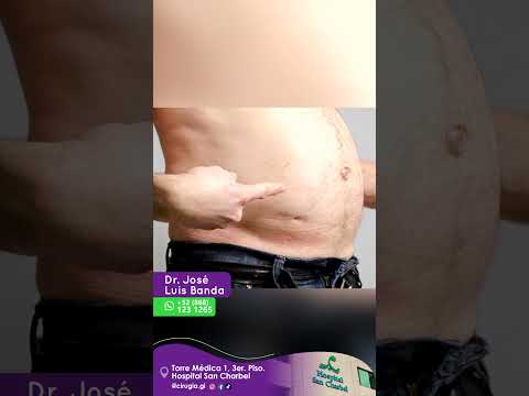 Jose Luis Banda-29
