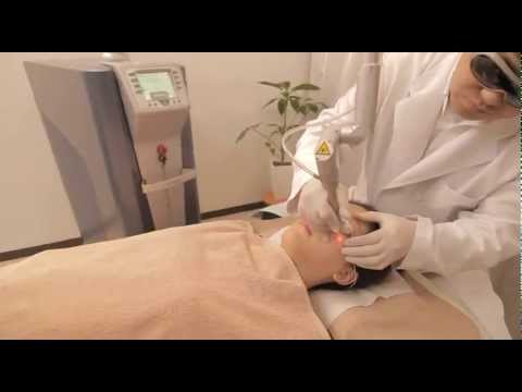 茶アザの扁平母斑 原因と治療。遺伝関係ある？レーザー再発？ | イケてる男子のブレインミルク