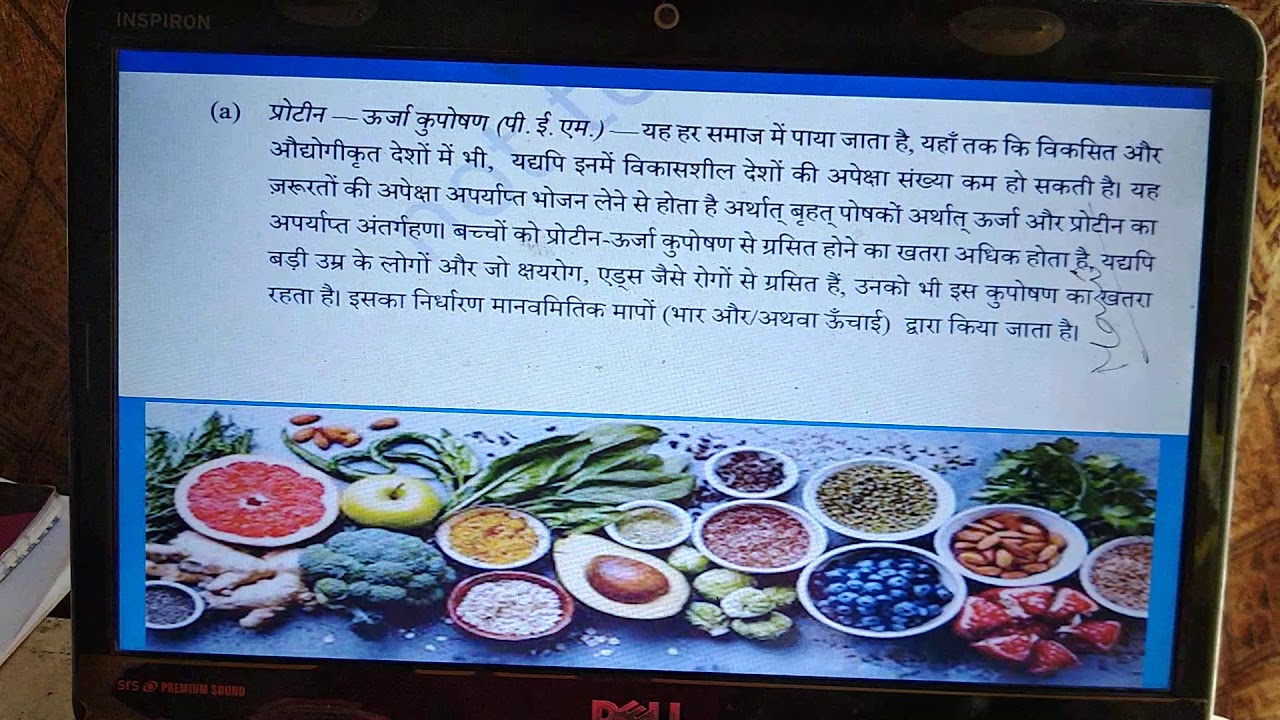 HOME SCIENCE CLASS 12 | CBSE | Unit 2| Chapter 3|  Protein Energy.Malnutrition and Anemia.
