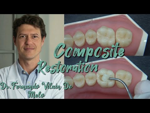 Composite restoration technique. Modeling anatomy teeth. Dr. Fernando Vilain De Melo