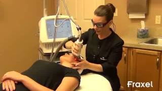 Thermage® - Lafayette, LA - Dr. Cynthia Glass