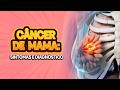 Sinais e Sintomas do Câncer de Mama | IMEB