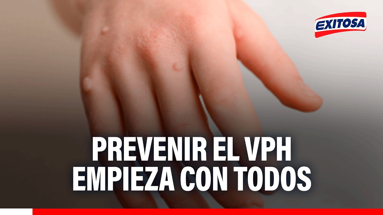 🔴🔵 Prevenir el VPH empieza con todos
