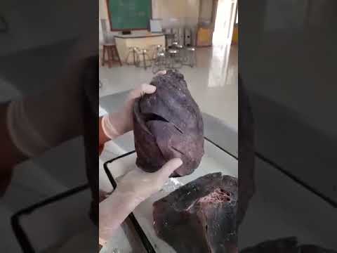 Demonstration of Lungs