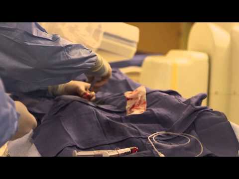 University of California San Francisco, Neurovascular Service - Collaboration is Key