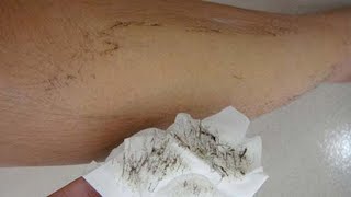 In 5 Minutes, Remove Unwanted Body Hair Permanently, NO SHAVE NO WAX, From First Use Hair Removal