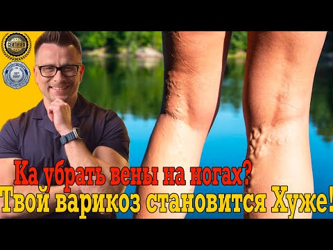 Почему варикоз становится все хуже! Как очистить ноги от вен! Почему варикоз становится все хуже! Как очистить ноги от вен!