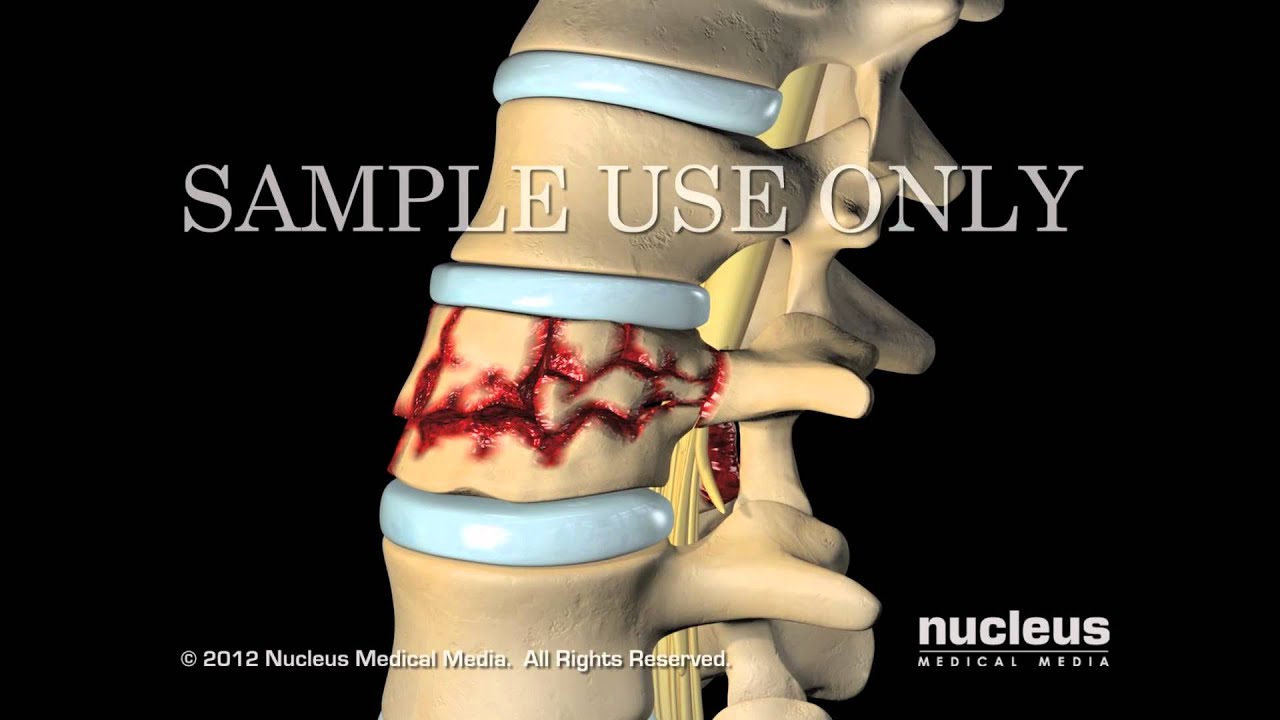 Marco Antonio Altamirano Cruz-18