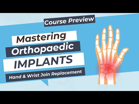 Mastering Orthopaedic Implants - Hand & Wrist Joint Replacement
