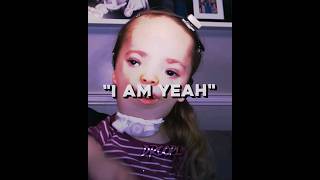 Bro so wrong for that☠️☠️ #guy #downsyndrome #edit