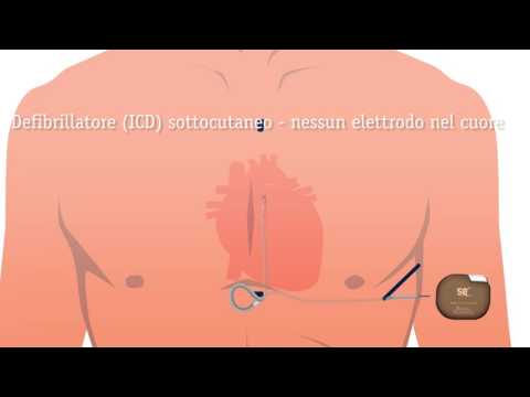 Rivestimento per pneumatico è danneggiato caviglia Il dolore cronico alla schiena sopra la vita