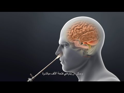Hypophysis adenoma és ízületi fájdalmak.