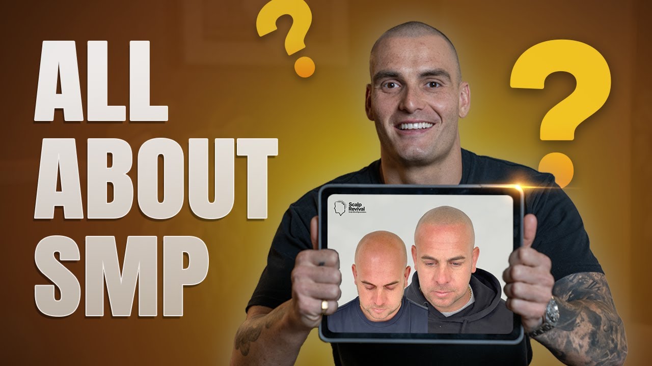 Watch: How Scalp Revival transforms hair loss