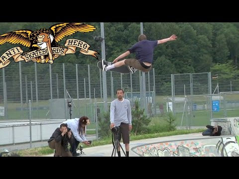 Anti-Hero's "What's Up Monkey?" Part 3