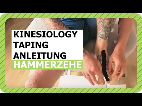 Hammerzehe richtig tapen - Kinesiology-Tape Anleitung für Hammerzehe | Netztherapeuten