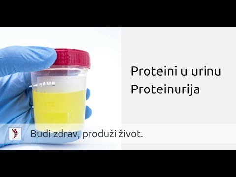 urina od hipertenzije