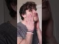 How Brian Turner Got Rid of His Acne Scars At Home #shorts