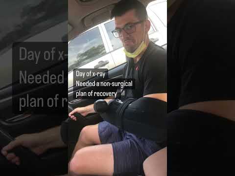 Non-Surgical Grade 3 AC Separation Recovery Using The AC Joint Separation Crash Course & Protocol!