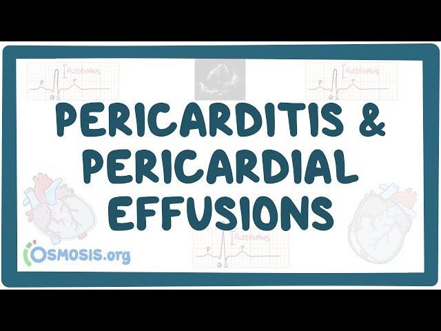 Video Aussprache von pericarditis in Englisch